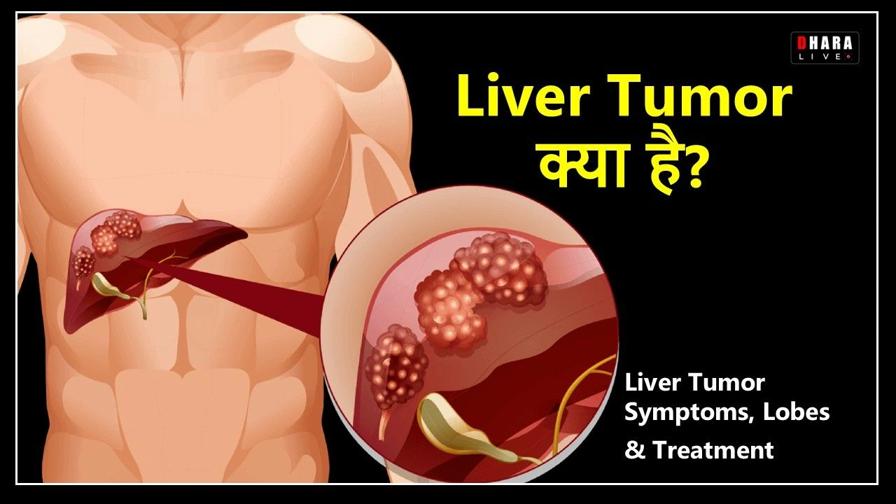 what-is-liver-tumor-symptoms-lobes-diagnosis-and-latest-treatment-guide-of-2025